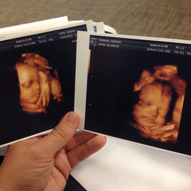 Baby Tessa’s 28 Week 3D Ultrasound Domestic Geek Girl